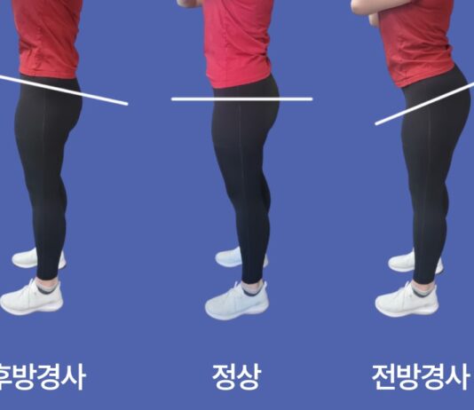 필라테스가 골반 균형을 맞추는 데 효과적인 이유